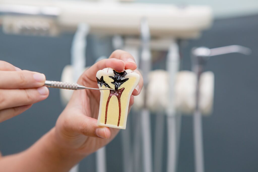 muestra de endodoncia en diente falso