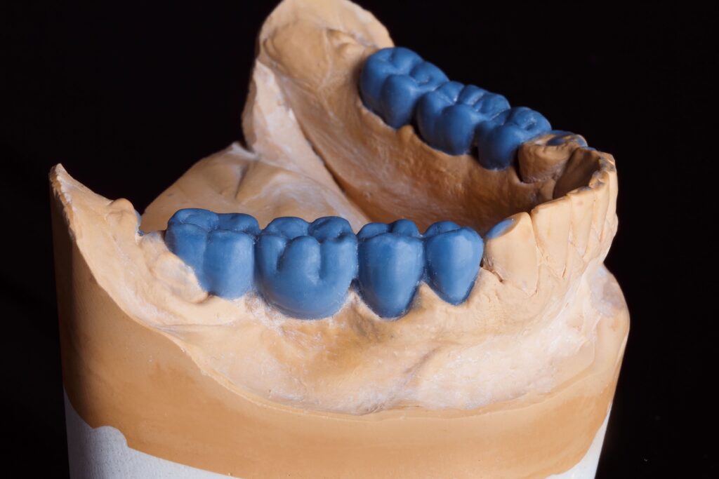 muestra de dentadura digitalizada